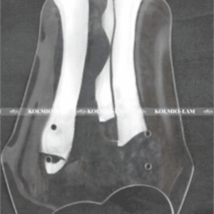 Windscreen Fit For BMW G 650 GS F700GS F800GS Windshield Wind Deflectors Front Class  2008 -2017